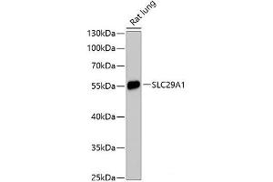 Western blot analysis of extracts of Rat lung using SLC29A1 Polyclonal Antibody at dilution of 1:3000. (SLC29A1 抗体)