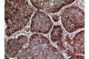Immunohistochemistry (IHC) analysis of paraffin-embedded Human Lung, antibody was diluted at 1:100. (IL-24 抗体  (Internal Region))