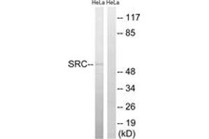 Western blot analysis of extracts from HeLa cells, treated with Hu 2nM 24h, using Src (Ab-75) Antibody. (Src 抗体  (AA 41-90))