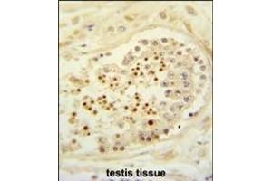 Formalin-fixed and paraffin-embedded human testis tissue reacted with CBLB Antibody (Center), which was peroxidase-conjugated to the secondary antibody, followed by DAB staining. (Cbl Proto-Oncogene B, E3 Ubiquitin Protein Ligase (CBLB) (AA 103-130) 抗体)