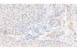 Detection of CRP in Human Liver Tissue using Monoclonal Antibody to C Reactive Protein (CRP) (CRP 抗体  (AA 17-224))
