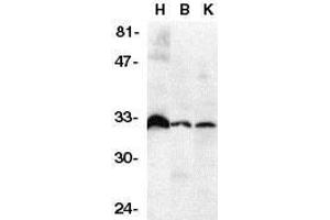 Western blot analysis of DcR3 in human heart (H), brain (B), and kidney (K) tissue lysates with DcR3 antibody at 1μg/ml. (TNFRSF6B 抗体)