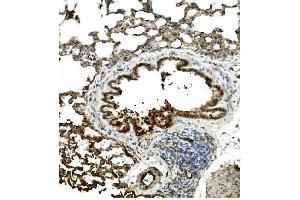 IHC analysis of Caveolin-2 using anti-Caveolin-2 antibody (ABIN3043749). (Caveolin 2 抗体  (AA 1-162))