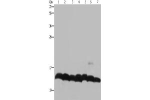 Western Blotting (WB) image for anti-Histone H4 antibody (ABIN2423581) (Histone H4 抗体)