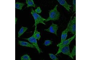 Immunofluorescence analysis of HeLa cells using MAP2K6 monoclonal antibody, clone 3H12C8  (green).