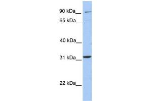 WB Suggested Anti-ELFN2 Antibody Titration:  0. (ELFN2 抗体  (N-Term))