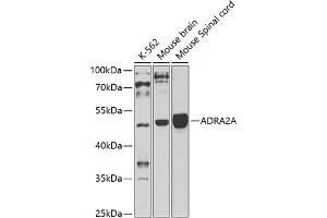 Western blot analysis of extracts of various cell lines, using A antibody (ABIN3016751, ABIN3016752, ABIN3016753 and ABIN6219833) at 1:1000 dilution. (ADRA2A 抗体  (AA 240-380))