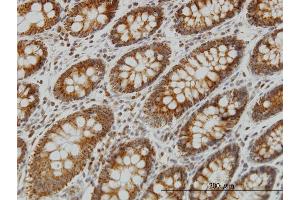 Immunoperoxidase of monoclonal antibody to NDUFS4 on formalin-fixed paraffin-embedded human colon.