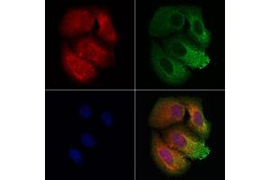 ABIN7093832 and ABIN7097875 staining Hela cells by IF/ICC. (BBS9 抗体  (C-Term))