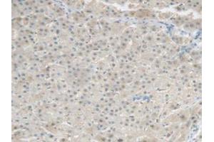 IHC-P analysis of Human Liver Tissue, with DAB staining. (CRP 抗体  (AA 17-224))
