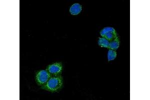 anti-Ubiquitin Specific Peptidase 21 (USP21) (AA 277-565) antibody