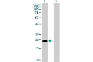 Western Blot analysis of NME6 expression in transfected 293T cell line by NME6 MaxPab polyclonal antibody. (NME6 抗体  (AA 1-194))