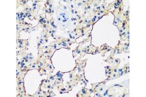 Immunohistochemistry of paraffin-embedded Rat lung using ALOX15 Polyclonal Antibody at dilution of 1:200 (40x lens). (ALOX15 抗体)