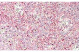 Detection of JAG1 in Human Spleen Tissue using Polyclonal Antibody to Jagged 1 (JAG1) (JAG1 抗体  (AA 33-250))