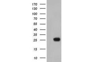 HEK293T cells were transfected with the pCMV6-ENTRY control (Left lane) or pCMV6-ENTRY MOBKL2B (Right lane) cDNA for 48 hrs and lysed. (MOBKL2B 抗体)