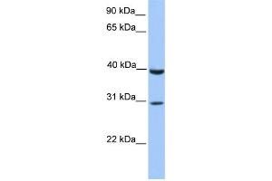 WB Suggested Anti-JAZF1 Antibody Titration:  0.