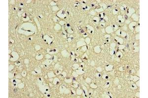 Immunohistochemistry of paraffin-embedded human brain tissue using ABIN7162631 at dilution of 1:100 (PNMA5 抗体  (AA 4-442))