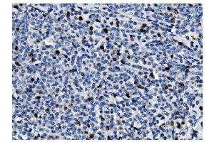 IHC analysis of Ki67 using anti-Ki67 antibody (ABIN7601101).