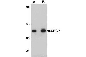 Western blot analysis of APC7 in rat kidney tissue lysate with AP30063PU-N APC7 antibody at (A) 1 and (B) 2 μg/ml.
