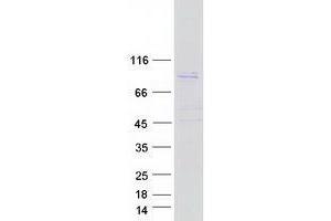 Western Blotting (WB) image for Tetratricopeptide Repeat Domain 39B (TTC39B) (Transcript Variant 2) protein (Myc-DYKDDDDK Tag) (ABIN2734494)