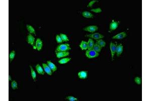 Immunofluorescence (IF) image for anti-Solute Carrier Family 28 (Sodium-Coupled Nucleoside Transporter), Member 1 (SLC28A1) (AA 1-80) antibody (ABIN7170032)