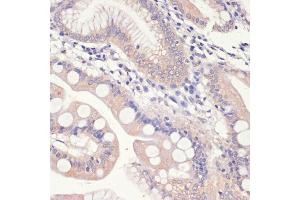 Immunohistochemistry of paraffin-embedded human small intestine using HMGCR antibody (ABIN3022293, ABIN3022294, ABIN3022295, ABIN1513022 and ABIN6218714) at dilution of 1:200 (40x lens).