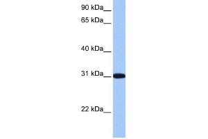 RFPL2 antibody used at 1 ug/ml to detect target protein. (RFPL2 抗体  (C-Term))