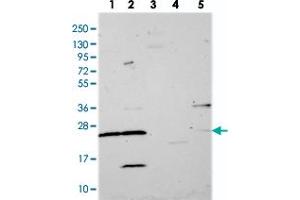 Western blot analysis of Lane 1: RT-4, Lane 2: U-251 MG, Lane 3: Human Plasma, Lane 4: Liver, Lane 5: Tonsil with MRPS26 polyclonal antibody  at 1:250-1:500 dilution.
