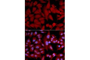 Immunofluorescence analysis of U2OS cells using PSMA4 antibody (ABIN5971344). (PSMA4 抗体)