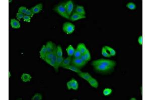 Immunofluorescent analysis of HepG2 cells using ABIN7162750 at dilution of 1:100 and Alexa Fluor 488-congugated AffiniPure Goat Anti-Rabbit IgG(H+L) (PTX3 抗体  (AA 99-164))