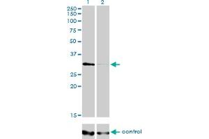 Western blot analysis of HDAC7A over-expressed 293 cell line, cotransfected with HDAC7A Validated Chimera RNAi (Lane 2) or non-transfected control (Lane 1). (HDAC7 抗体  (AA 1-276))