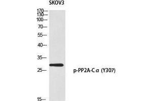 Western Blot (WB) analysis of SKOV3 using p-PP2A-Calpha (Y307) antibody. (PPP2CA 抗体  (pTyr307))