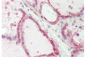 Rabbit Anti-ATE1 antibody  Formalin Fixed Paraffin Embedded Tissue: Human Thyroid Primary antibody Concentration: 1:100 Secondary Antibody: Donkey anti-Rabbit-Cy3 Secondary Antibody Concentration: 1:200 Magnification: 20x Exposure Time: 0. (ATE1 抗体  (Middle Region))