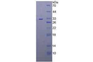 SDS-PAGE analysis of Human TRAF4 Protein. (TRAF4 蛋白)