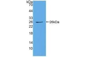 Detection of Recombinant CX43, Human using Polyclonal Antibody to Connexin 43 (CX43) (Connexin 43/GJA1 抗体  (AA 244-382))