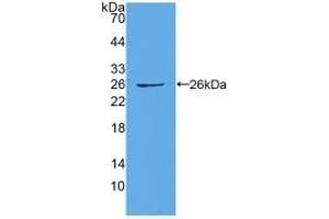 Detection of Recombinant CX43, Human using Polyclonal Antibody to Connexin 43 (CX43) (Connexin 43/GJA1 抗体  (AA 244-382))