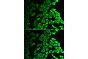 Immunofluorescence analysis of A549 cells using IL18BP antibody (ABIN5973845). (IL18BP 抗体)