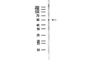 anti-Suppression of Tumorigenicity 13 (ST13) antibody