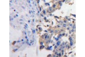 Used in DAB staining on fromalin fixed paraffin-embedded ovary tissue (PDGFD 抗体  (AA 19-370))