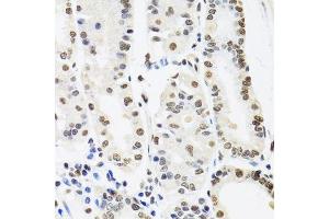 Immunohistochemistry of paraffin-embedded human stomach using SFPQ antibody.