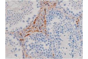 ABIN6267471 at 1/200 staining Mouse testis tissue sections by IHC-P. (AKT1 抗体  (pSer124))