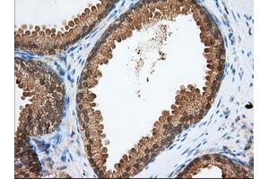 Immunohistochemical staining of paraffin-embedded Human pancreas tissue using anti-PDE4A mouse monoclonal antibody. (PDE4A 抗体)