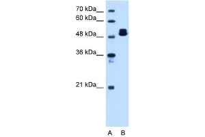 Western Blotting (WB) image for anti-ATP Synthase, H+ Transporting, Mitochondrial F1 Complex, beta Polypeptide (ATP5B) (C-Term) antibody (ABIN2783269)