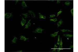 Immunofluorescence (IF) image for anti-serine/threonine Kinase 3 (STK3) (AA 311-431) antibody (ABIN520576)