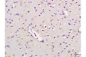 Formalin-fixed and paraffin embedded rat brain labeled with Anti-NUP50 Polyclonal Antibody, Unconjugated (ABIN873330) at 1:200 followed by conjugation to the secondary antibody and DAB staining (NUP50 抗体  (AA 351-450))