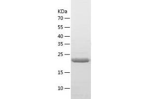 Western Blotting (WB) image for Tryptase beta 2 (TPSB2) (AA 32-276) protein (His tag) (ABIN7125509) (TPSB2 Protein (AA 32-276) (His tag))