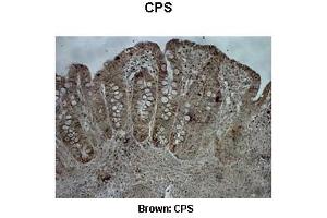 Immunohistochemistry (IHC) image for anti-Carbamoyl-Phosphate Synthase 1, Mitochondrial (CPS1) (Middle Region) antibody (ABIN2782319)