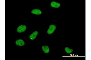 Immunofluorescence of purified MaxPab antibody to AOF2 on HeLa cell. (LSD1 抗体  (AA 1-876))