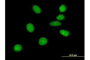 Immunofluorescence of purified MaxPab antibody to ASCIZ on HeLa cell. (ATM Interactor 抗体  (AA 1-667))