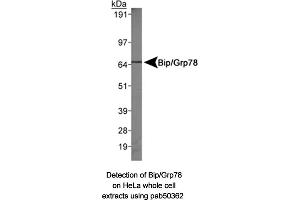 Image no. 1 for anti-Heat Shock 70kDa Protein 5 (Glucose-Regulated Protein, 78kDa) (HSPA5) (AA 250-300), (Internal Region) antibody (ABIN363671) (GRP78 抗体  (Internal Region))